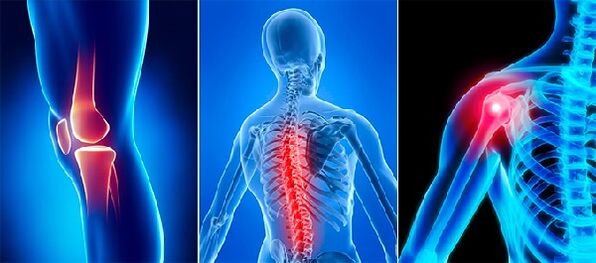 Joint pain in arthrosis
