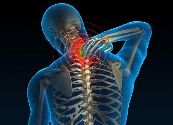 pain in the cervical spine with osteochondrosis