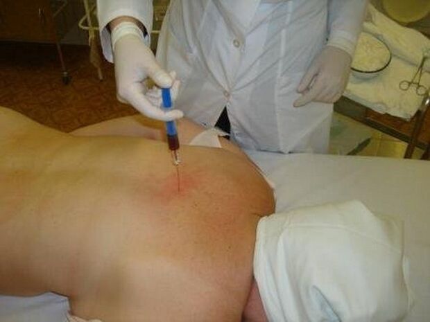 Injection